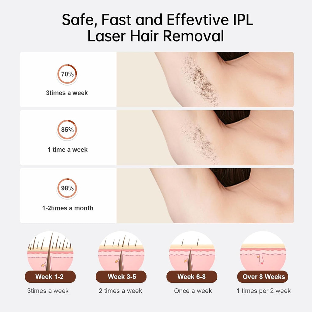 Laser Hair Removal,  Hair Removal Device with Ice Cooling Care Function, Visible Results in 2 Weeks, Laser Hair Removal for Women and Men Care Painless Safe Gentle at Home Full Body, White